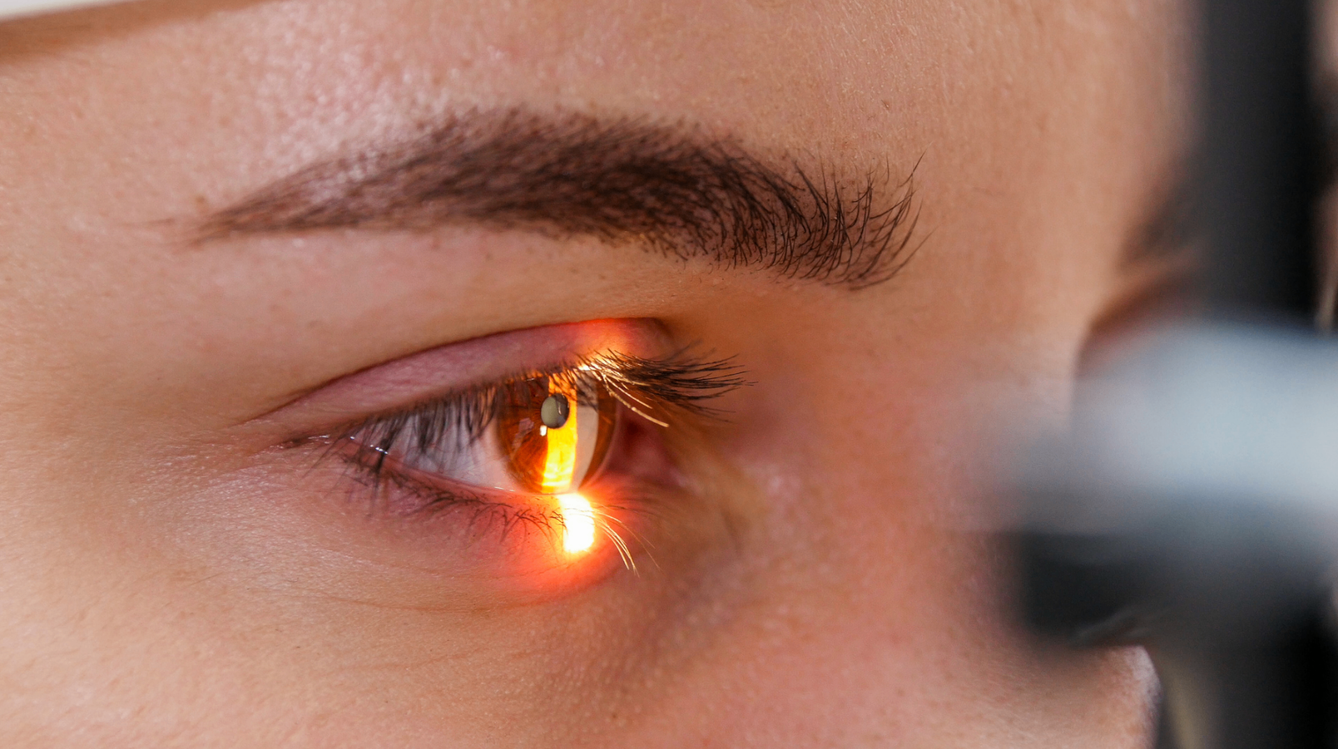 Retina